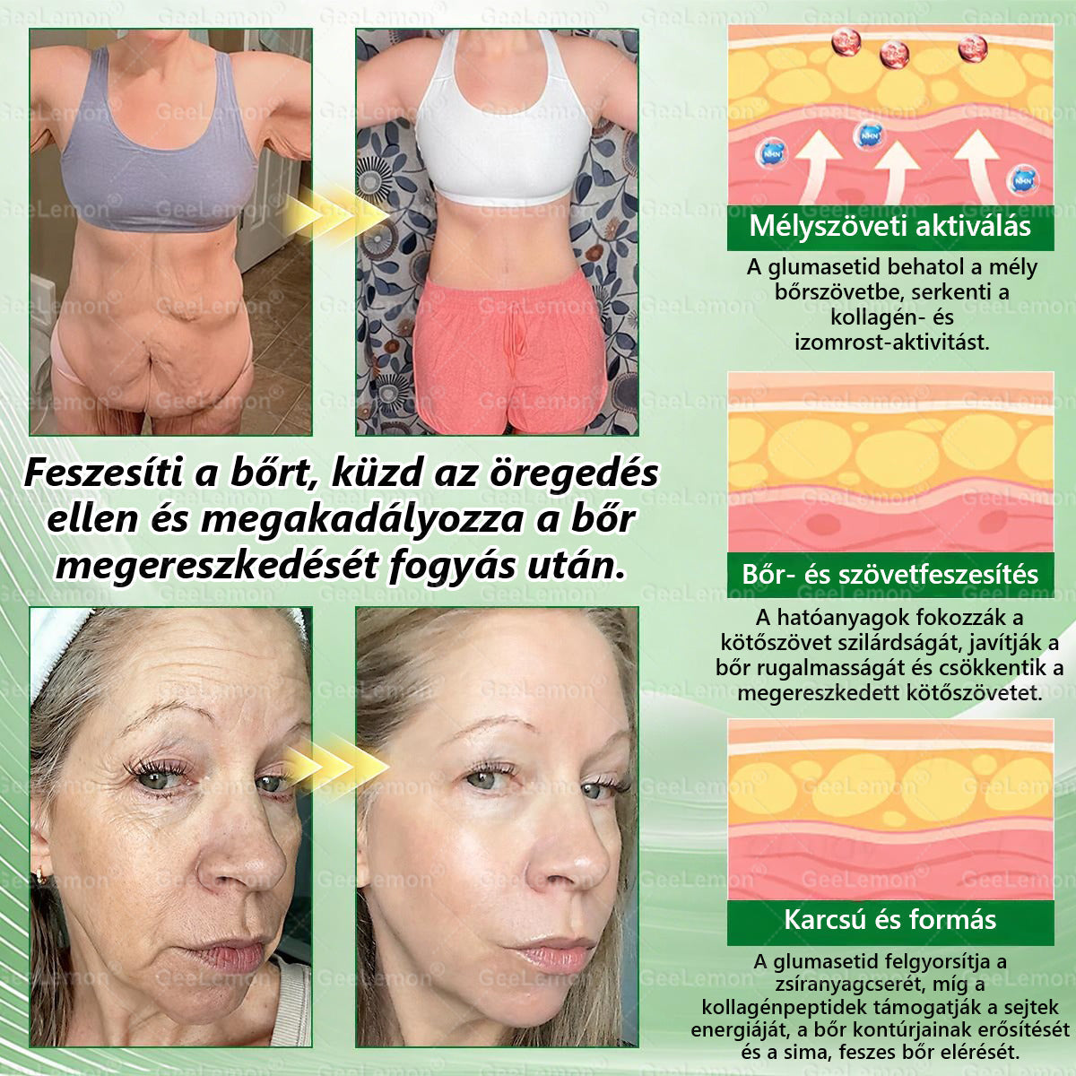 𝐆𝐞𝑒𝐿𝑒𝐦𝐨𝐧® Glumasetide 8 az 1-ben Karcsú és Egészséges Nano Mikrotűs Tapasz ✅