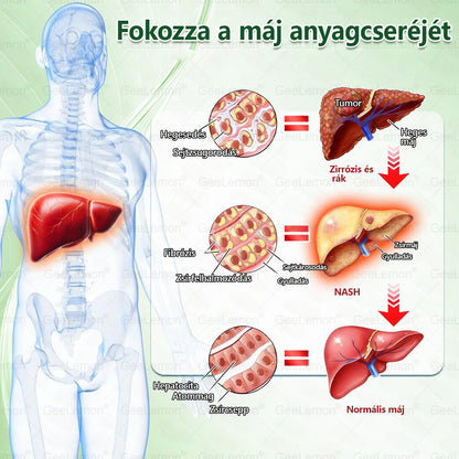 𝐆𝐞𝑒𝐿𝑒𝐦𝐨𝐧® Glumasetide 8 az 1-ben Karcsú és Egészséges Nano Mikrotűs Tapasz ✅