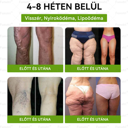Magyar szakértők által ajánlott 🍏Funutri® 10 az 1-ben anyagcsere-támogató karcsúsító nano mikro-tűs tapasz