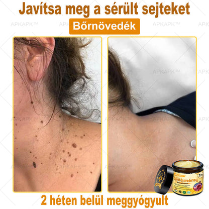 𝐀𝐏𝐊𝐀𝐏𝐊® 𝐌É𝐇𝐌É𝐑𝐄𝐆 Á𝐓𝐅𝐎𝐆Ó 𝐊𝐑É𝐌🥇𝐀 𝐛ö𝐫𝐩𝐫𝐨𝐛𝐥é𝐦á𝐤 𝐤𝐞𝐳𝐞𝐥é𝐬𝐞 𝐦𝐚𝐠á𝐛𝐚𝐧 𝐟𝐨𝐠𝐥𝐚𝐥𝐣𝐚: é𝐥𝐞𝐭𝐤𝐨𝐫𝐢 𝐟𝐨𝐥𝐭𝐨𝐤, 𝐡𝐞𝐠𝐞𝐤, 𝐬𝐳𝐞𝐦ö𝐥𝐜𝐬ö𝐤, 𝐛ö𝐫𝐧ö𝐯𝐞𝐝é𝐤𝐞𝐤, 𝐭á𝐥𝐲𝐨𝐠𝐨𝐤, 𝐩𝐚𝐭𝐭𝐚𝐧á𝐬𝐨𝐤, 𝐞𝐤𝐜é𝐦𝐚, 𝐩𝐬𝐨𝐫𝐢𝐚𝐬𝐢𝐬, 𝐚𝐜𝐧𝐞 𝐢𝐧𝐯𝐞𝐫𝐬𝐚, 𝐫á𝐧𝐜𝐨𝐤, 𝐛ö𝐫ö𝐫𝐞𝐠𝐞𝐝é𝐬 é𝐬 𝐞𝐠𝐲é𝐛 𝐩𝐫𝐨𝐛𝐥é𝐦á𝐤✅