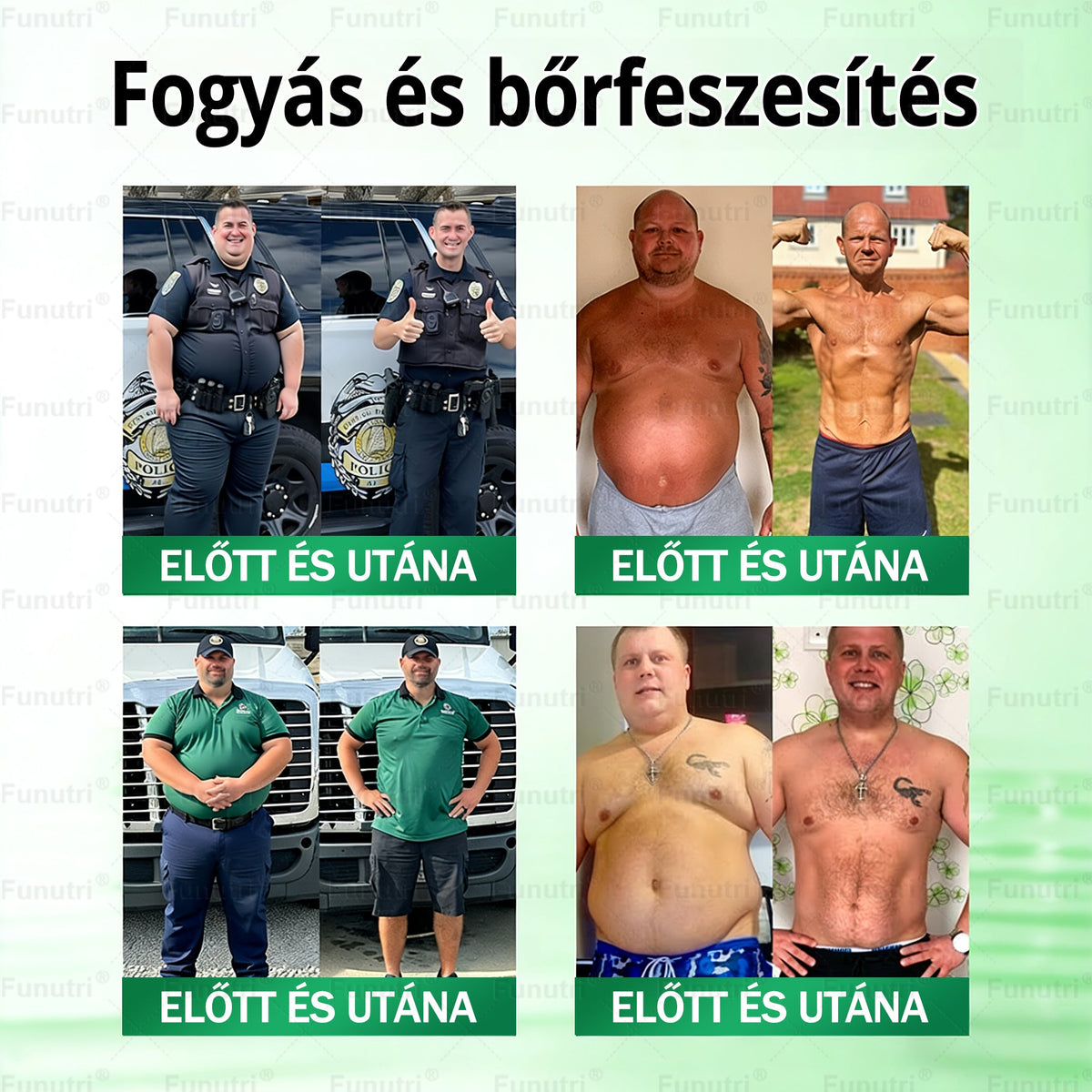Magyar szakértők által ajánlott 🍏Funutri® 10 az 1-ben anyagcsere-támogató karcsúsító nano mikro-tűs tapasz