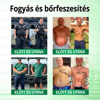 Magyar szakértők által ajánlott 🍏Funutri® 10 az 1-ben anyagcsere-támogató karcsúsító nano mikro-tűs tapasz