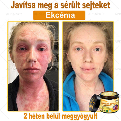 𝐀𝐏𝐊𝐀𝐏𝐊® 𝐌É𝐇𝐌É𝐑𝐄𝐆 Á𝐓𝐅𝐎𝐆Ó 𝐊𝐑É𝐌🥇𝐀 𝐛ö𝐫𝐩𝐫𝐨𝐛𝐥é𝐦á𝐤 𝐤𝐞𝐳𝐞𝐥é𝐬𝐞 𝐦𝐚𝐠á𝐛𝐚𝐧 𝐟𝐨𝐠𝐥𝐚𝐥𝐣𝐚: é𝐥𝐞𝐭𝐤𝐨𝐫𝐢 𝐟𝐨𝐥𝐭𝐨𝐤, 𝐡𝐞𝐠𝐞𝐤, 𝐬𝐳𝐞𝐦ö𝐥𝐜𝐬ö𝐤, 𝐛ö𝐫𝐧ö𝐯𝐞𝐝é𝐤𝐞𝐤, 𝐭á𝐥𝐲𝐨𝐠𝐨𝐤, 𝐩𝐚𝐭𝐭𝐚𝐧á𝐬𝐨𝐤, 𝐞𝐤𝐜é𝐦𝐚, 𝐩𝐬𝐨𝐫𝐢𝐚𝐬𝐢𝐬, 𝐚𝐜𝐧𝐞 𝐢𝐧𝐯𝐞𝐫𝐬𝐚, 𝐫á𝐧𝐜𝐨𝐤, 𝐛ö𝐫ö𝐫𝐞𝐠𝐞𝐝é𝐬 é𝐬 𝐞𝐠𝐲é𝐛 𝐩𝐫𝐨𝐛𝐥é𝐦á𝐤✅