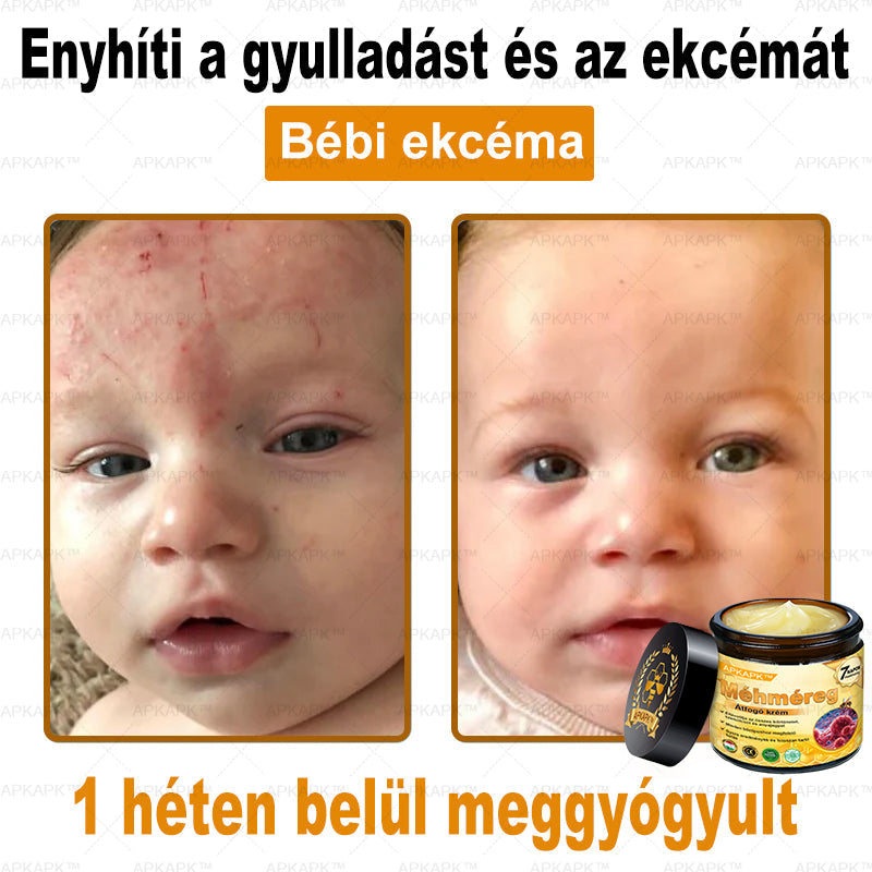 𝐀𝐏𝐊𝐀𝐏𝐊® 𝐌É𝐇𝐌É𝐑𝐄𝐆 Á𝐓𝐅𝐎𝐆Ó 𝐊𝐑É𝐌🥇𝐀 𝐛ö𝐫𝐩𝐫𝐨𝐛𝐥é𝐦á𝐤 𝐤𝐞𝐳𝐞𝐥é𝐬𝐞 𝐦𝐚𝐠á𝐛𝐚𝐧 𝐟𝐨𝐠𝐥𝐚𝐥𝐣𝐚: é𝐥𝐞𝐭𝐤𝐨𝐫𝐢 𝐟𝐨𝐥𝐭𝐨𝐤, 𝐡𝐞𝐠𝐞𝐤, 𝐬𝐳𝐞𝐦ö𝐥𝐜𝐬ö𝐤, 𝐛ö𝐫𝐧ö𝐯𝐞𝐝é𝐤𝐞𝐤, 𝐭á𝐥𝐲𝐨𝐠𝐨𝐤, 𝐩𝐚𝐭𝐭𝐚𝐧á𝐬𝐨𝐤, 𝐞𝐤𝐜é𝐦𝐚, 𝐩𝐬𝐨𝐫𝐢𝐚𝐬𝐢𝐬, 𝐚𝐜𝐧𝐞 𝐢𝐧𝐯𝐞𝐫𝐬𝐚, 𝐫á𝐧𝐜𝐨𝐤, 𝐛ö𝐫ö𝐫𝐞𝐠𝐞𝐝é𝐬 é𝐬 𝐞𝐠𝐲é𝐛 𝐩𝐫𝐨𝐛𝐥é𝐦á𝐤✅
