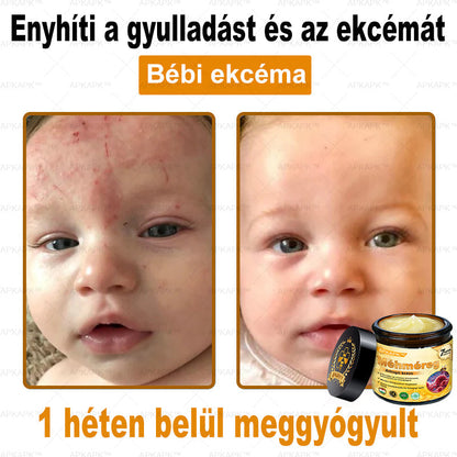 𝐀𝐏𝐊𝐀𝐏𝐊® 𝐌É𝐇𝐌É𝐑𝐄𝐆 Á𝐓𝐅𝐎𝐆Ó 𝐊𝐑É𝐌🥇𝐀 𝐛ö𝐫𝐩𝐫𝐨𝐛𝐥é𝐦á𝐤 𝐤𝐞𝐳𝐞𝐥é𝐬𝐞 𝐦𝐚𝐠á𝐛𝐚𝐧 𝐟𝐨𝐠𝐥𝐚𝐥𝐣𝐚: é𝐥𝐞𝐭𝐤𝐨𝐫𝐢 𝐟𝐨𝐥𝐭𝐨𝐤, 𝐡𝐞𝐠𝐞𝐤, 𝐬𝐳𝐞𝐦ö𝐥𝐜𝐬ö𝐤, 𝐛ö𝐫𝐧ö𝐯𝐞𝐝é𝐤𝐞𝐤, 𝐭á𝐥𝐲𝐨𝐠𝐨𝐤, 𝐩𝐚𝐭𝐭𝐚𝐧á𝐬𝐨𝐤, 𝐞𝐤𝐜é𝐦𝐚, 𝐩𝐬𝐨𝐫𝐢𝐚𝐬𝐢𝐬, 𝐚𝐜𝐧𝐞 𝐢𝐧𝐯𝐞𝐫𝐬𝐚, 𝐫á𝐧𝐜𝐨𝐤, 𝐛ö𝐫ö𝐫𝐞𝐠𝐞𝐝é𝐬 é𝐬 𝐞𝐠𝐲é𝐛 𝐩𝐫𝐨𝐛𝐥é𝐦á𝐤✅