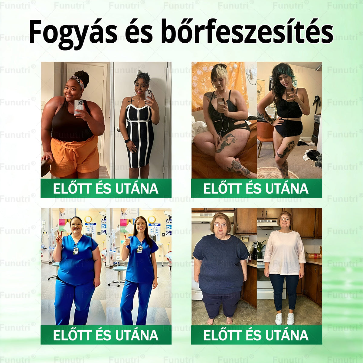 Magyar szakértők által ajánlott 🍏Funutri® 10 az 1-ben anyagcsere-támogató karcsúsító nano mikro-tűs tapasz
