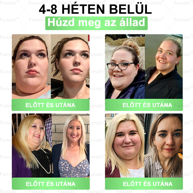 Magyar szakértők által ajánlott 🍏Funutri® 10 az 1-ben anyagcsere-támogató karcsúsító nano mikro-tűs tapasz