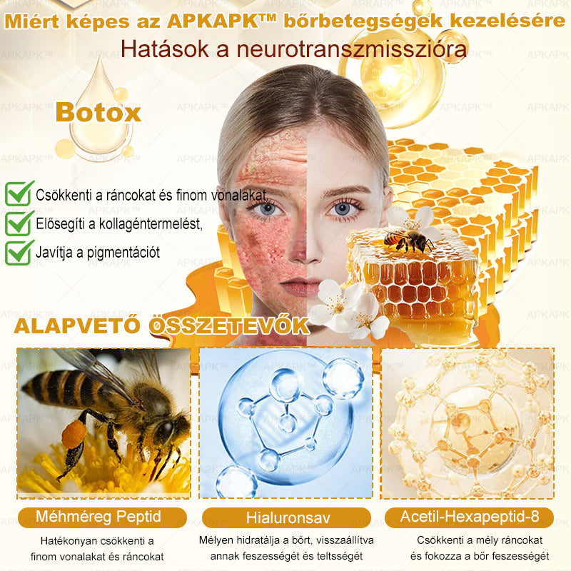𝐀𝐏𝐊𝐀𝐏𝐊® 𝐌É𝐇𝐌É𝐑𝐄𝐆 Á𝐓𝐅𝐎𝐆Ó 𝐊𝐑É𝐌🥇𝐀 𝐛ö𝐫𝐩𝐫𝐨𝐛𝐥é𝐦á𝐤 𝐤𝐞𝐳𝐞𝐥é𝐬𝐞 𝐦𝐚𝐠á𝐛𝐚𝐧 𝐟𝐨𝐠𝐥𝐚𝐥𝐣𝐚: é𝐥𝐞𝐭𝐤𝐨𝐫𝐢 𝐟𝐨𝐥𝐭𝐨𝐤, 𝐡𝐞𝐠𝐞𝐤, 𝐬𝐳𝐞𝐦ö𝐥𝐜𝐬ö𝐤, 𝐛ö𝐫𝐧ö𝐯𝐞𝐝é𝐤𝐞𝐤, 𝐭á𝐥𝐲𝐨𝐠𝐨𝐤, 𝐩𝐚𝐭𝐭𝐚𝐧á𝐬𝐨𝐤, 𝐞𝐤𝐜é𝐦𝐚, 𝐩𝐬𝐨𝐫𝐢𝐚𝐬𝐢𝐬, 𝐚𝐜𝐧𝐞 𝐢𝐧𝐯𝐞𝐫𝐬𝐚, 𝐫á𝐧𝐜𝐨𝐤, 𝐛ö𝐫ö𝐫𝐞𝐠𝐞𝐝é𝐬 é𝐬 𝐞𝐠𝐲é𝐛 𝐩𝐫𝐨𝐛𝐥é𝐦á𝐤✅