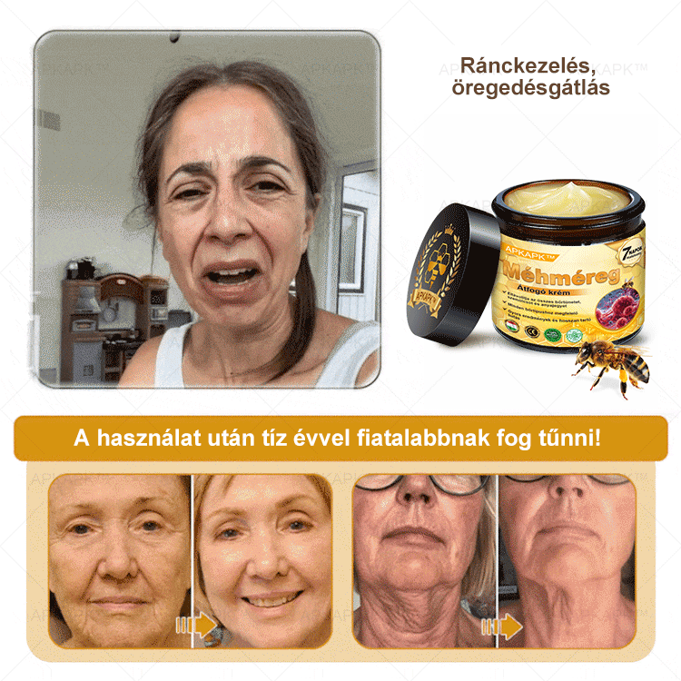 𝐀𝐏𝐊𝐀𝐏𝐊® 𝐌É𝐇𝐌É𝐑𝐄𝐆 Á𝐓𝐅𝐎𝐆Ó 𝐊𝐑É𝐌🥇𝐀 𝐛ö𝐫𝐩𝐫𝐨𝐛𝐥é𝐦á𝐤 𝐤𝐞𝐳𝐞𝐥é𝐬𝐞 𝐦𝐚𝐠á𝐛𝐚𝐧 𝐟𝐨𝐠𝐥𝐚𝐥𝐣𝐚: é𝐥𝐞𝐭𝐤𝐨𝐫𝐢 𝐟𝐨𝐥𝐭𝐨𝐤, 𝐡𝐞𝐠𝐞𝐤, 𝐬𝐳𝐞𝐦ö𝐥𝐜𝐬ö𝐤, 𝐛ö𝐫𝐧ö𝐯𝐞𝐝é𝐤𝐞𝐤, 𝐭á𝐥𝐲𝐨𝐠𝐨𝐤, 𝐩𝐚𝐭𝐭𝐚𝐧á𝐬𝐨𝐤, 𝐞𝐤𝐜é𝐦𝐚, 𝐩𝐬𝐨𝐫𝐢𝐚𝐬𝐢𝐬, 𝐚𝐜𝐧𝐞 𝐢𝐧𝐯𝐞𝐫𝐬𝐚, 𝐫á𝐧𝐜𝐨𝐤, 𝐛ö𝐫ö𝐫𝐞𝐠𝐞𝐝é𝐬 é𝐬 𝐞𝐠𝐲é𝐛 𝐩𝐫𝐨𝐛𝐥é𝐦á𝐤✅