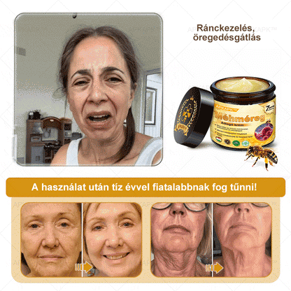 𝐀𝐏𝐊𝐀𝐏𝐊® 𝐌É𝐇𝐌É𝐑𝐄𝐆 Á𝐓𝐅𝐎𝐆Ó 𝐊𝐑É𝐌🥇𝐀 𝐛ö𝐫𝐩𝐫𝐨𝐛𝐥é𝐦á𝐤 𝐤𝐞𝐳𝐞𝐥é𝐬𝐞 𝐦𝐚𝐠á𝐛𝐚𝐧 𝐟𝐨𝐠𝐥𝐚𝐥𝐣𝐚: é𝐥𝐞𝐭𝐤𝐨𝐫𝐢 𝐟𝐨𝐥𝐭𝐨𝐤, 𝐡𝐞𝐠𝐞𝐤, 𝐬𝐳𝐞𝐦ö𝐥𝐜𝐬ö𝐤, 𝐛ö𝐫𝐧ö𝐯𝐞𝐝é𝐤𝐞𝐤, 𝐭á𝐥𝐲𝐨𝐠𝐨𝐤, 𝐩𝐚𝐭𝐭𝐚𝐧á𝐬𝐨𝐤, 𝐞𝐤𝐜é𝐦𝐚, 𝐩𝐬𝐨𝐫𝐢𝐚𝐬𝐢𝐬, 𝐚𝐜𝐧𝐞 𝐢𝐧𝐯𝐞𝐫𝐬𝐚, 𝐫á𝐧𝐜𝐨𝐤, 𝐛ö𝐫ö𝐫𝐞𝐠𝐞𝐝é𝐬 é𝐬 𝐞𝐠𝐲é𝐛 𝐩𝐫𝐨𝐛𝐥é𝐦á𝐤✅