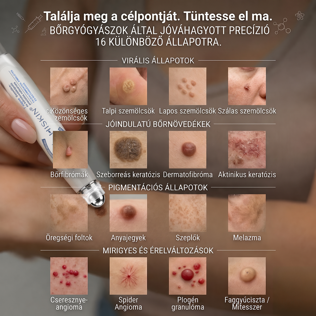🎁 Hiskin® 7 napos Szemölcseltávolító Roll-on Ápoló Folyadék