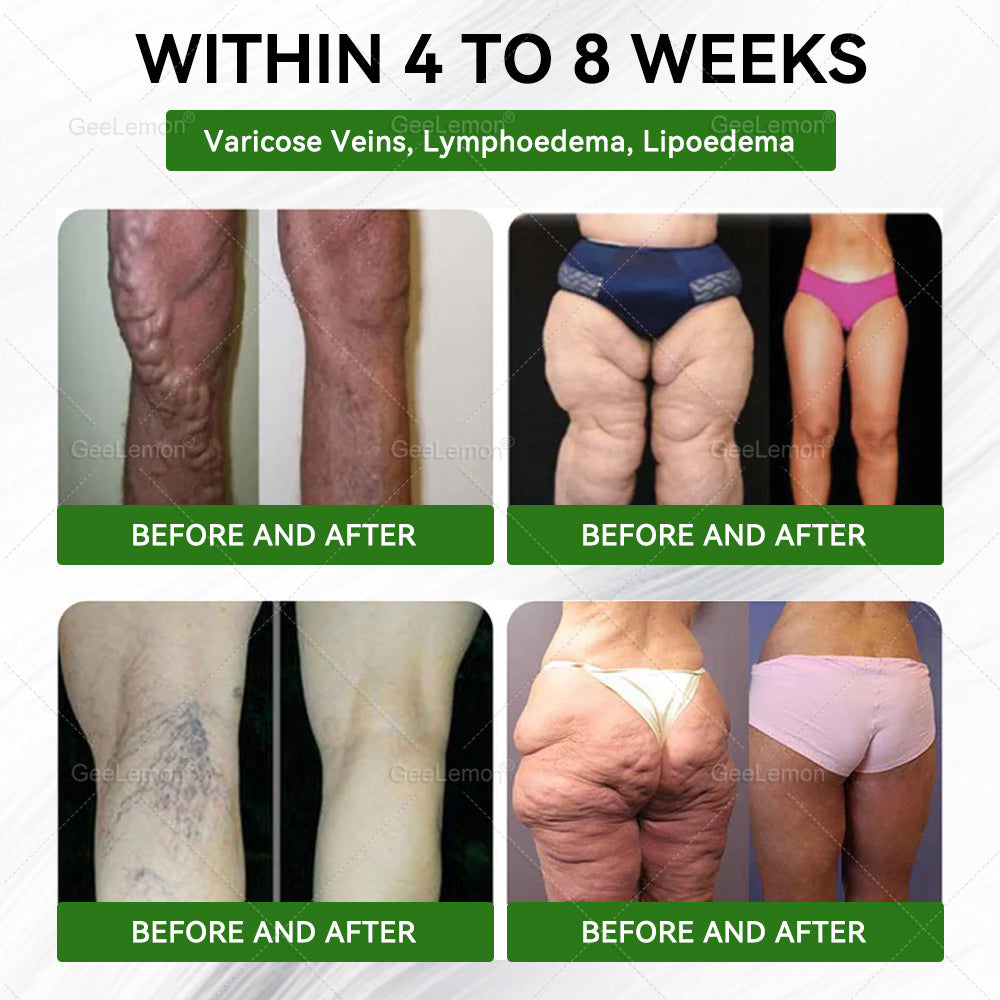 𝐆𝐞𝐞𝐋𝐞𝐦𝐨𝐧® 𝐌𝐨𝐫𝐢𝐧𝐠𝐚 · 𝐁𝐞𝐫𝐛𝐞𝐫𝐢𝐧𝐞 × 𝐍𝐀𝐃+ 𝟏𝟎-𝐢𝐧-𝟏 𝐀𝐝𝐯𝐚𝐧𝐜𝐞𝐝 𝐍𝐚𝐧𝐨 𝐌𝐢𝐜𝐫𝐨𝐧𝐞𝐞𝐝𝐥𝐞 𝐏𝐚𝐭𝐜𝐡