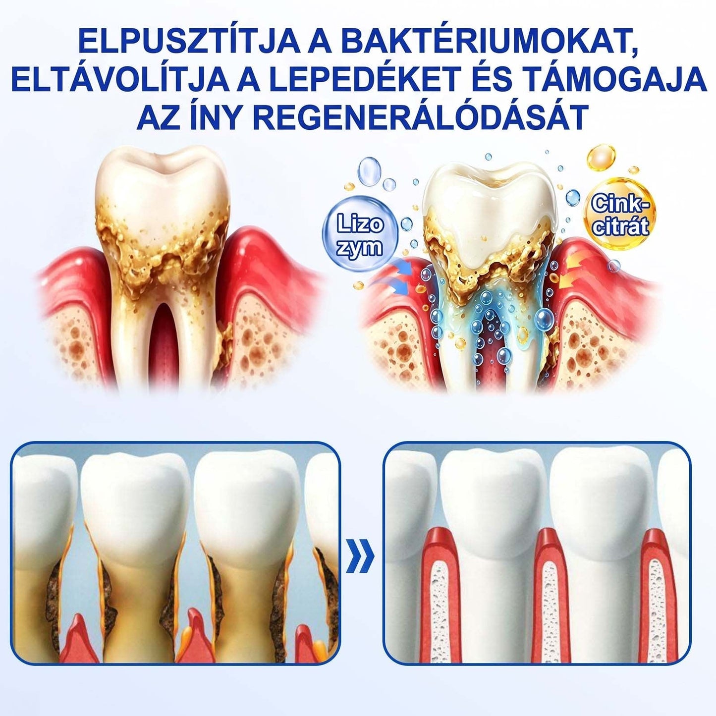 PureShade® 🦷 GumRevive Ínyregeneráló Gél – Az egészségesebb ínyért és magabiztosabb mosolyért 👍