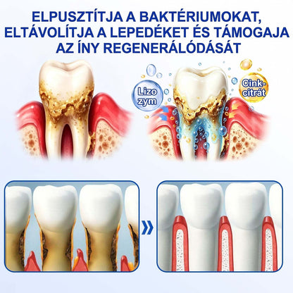 PureShade® 🦷 GumRevive Ínyregeneráló Gél – Az egészségesebb ínyért és magabiztosabb mosolyért 👍