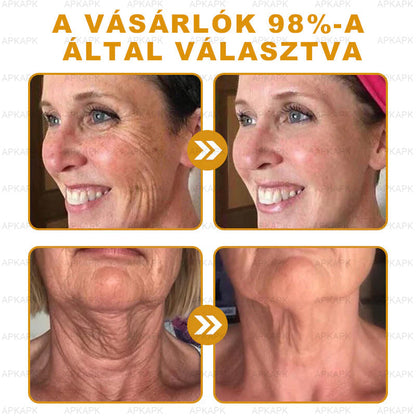 𝐀𝐏𝐊𝐀𝐏𝐊® 𝐌É𝐇𝐌É𝐑𝐄𝐆 Á𝐓𝐅𝐎𝐆Ó 𝐊𝐑É𝐌🥇𝐀 𝐛ö𝐫𝐩𝐫𝐨𝐛𝐥é𝐦á𝐤 𝐤𝐞𝐳𝐞𝐥é𝐬𝐞 𝐦𝐚𝐠á𝐛𝐚𝐧 𝐟𝐨𝐠𝐥𝐚𝐥𝐣𝐚: é𝐥𝐞𝐭𝐤𝐨𝐫𝐢 𝐟𝐨𝐥𝐭𝐨𝐤, 𝐡𝐞𝐠𝐞𝐤, 𝐬𝐳𝐞𝐦ö𝐥𝐜𝐬ö𝐤, 𝐛ö𝐫𝐧ö𝐯𝐞𝐝é𝐤𝐞𝐤, 𝐭á𝐥𝐲𝐨𝐠𝐨𝐤, 𝐩𝐚𝐭𝐭𝐚𝐧á𝐬𝐨𝐤, 𝐞𝐤𝐜é𝐦𝐚, 𝐩𝐬𝐨𝐫𝐢𝐚𝐬𝐢𝐬, 𝐚𝐜𝐧𝐞 𝐢𝐧𝐯𝐞𝐫𝐬𝐚, 𝐫á𝐧𝐜𝐨𝐤, 𝐛ö𝐫ö𝐫𝐞𝐠𝐞𝐝é𝐬 é𝐬 𝐞𝐠𝐲é𝐛 𝐩𝐫𝐨𝐛𝐥é𝐦á𝐤✅