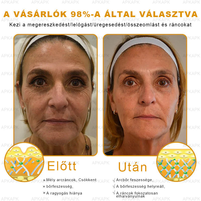 𝐀𝐏𝐊𝐀𝐏𝐊® 𝐌É𝐇𝐌É𝐑𝐄𝐆 Á𝐓𝐅𝐎𝐆Ó 𝐊𝐑É𝐌🥇𝐀 𝐛ö𝐫𝐩𝐫𝐨𝐛𝐥é𝐦á𝐤 𝐤𝐞𝐳𝐞𝐥é𝐬𝐞 𝐦𝐚𝐠á𝐛𝐚𝐧 𝐟𝐨𝐠𝐥𝐚𝐥𝐣𝐚: é𝐥𝐞𝐭𝐤𝐨𝐫𝐢 𝐟𝐨𝐥𝐭𝐨𝐤, 𝐡𝐞𝐠𝐞𝐤, 𝐬𝐳𝐞𝐦ö𝐥𝐜𝐬ö𝐤, 𝐛ö𝐫𝐧ö𝐯𝐞𝐝é𝐤𝐞𝐤, 𝐭á𝐥𝐲𝐨𝐠𝐨𝐤, 𝐩𝐚𝐭𝐭𝐚𝐧á𝐬𝐨𝐤, 𝐞𝐤𝐜é𝐦𝐚, 𝐩𝐬𝐨𝐫𝐢𝐚𝐬𝐢𝐬, 𝐚𝐜𝐧𝐞 𝐢𝐧𝐯𝐞𝐫𝐬𝐚, 𝐫á𝐧𝐜𝐨𝐤, 𝐛ö𝐫ö𝐫𝐞𝐠𝐞𝐝é𝐬 é𝐬 𝐞𝐠𝐲é𝐛 𝐩𝐫𝐨𝐛𝐥é𝐦á𝐤✅