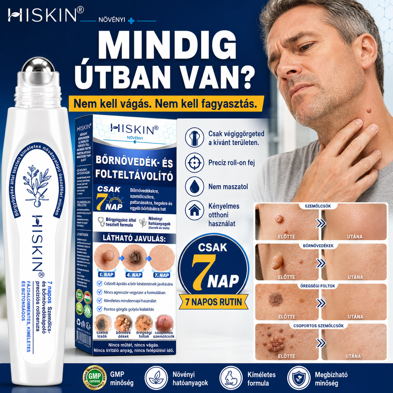 🎁 Hiskin® 7 napos Szemölcseltávolító Roll-on Ápoló Folyadék