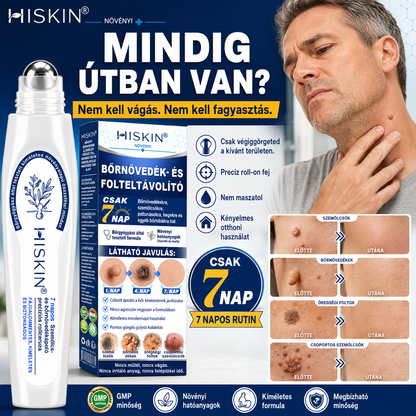 🎁 Hiskin® 7 napos Szemölcseltávolító Roll-on Ápoló Folyadék